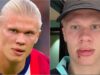 Erling Haaland sofreu uma lesão facial bizarra no ônibus da seleção norueguesa
