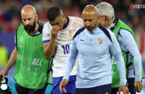 Mbappé usará máscara modificada após nariz quebrado